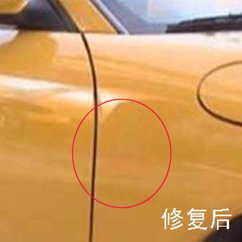 凹陷修复后